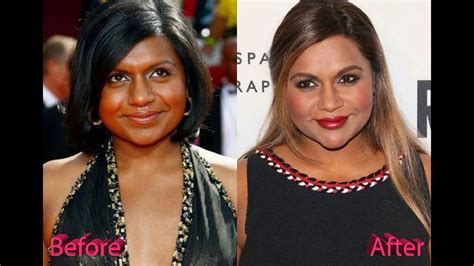 mindy kaling before|These Before